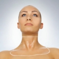 Tehohoitoa kaulan iholle - bt-ceuticals cosmetic - 10% Hyaluronihapponaamio