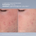 dermalogica Daily Microfoliant